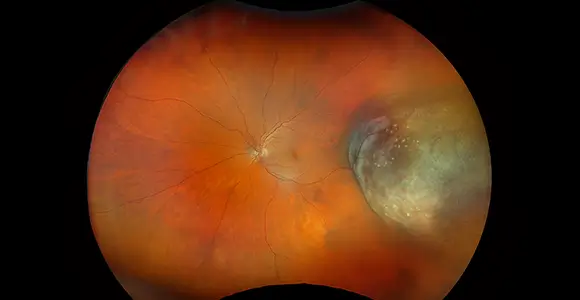 clical paper thumbnail image