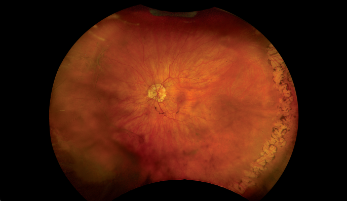 Clinical paper thumbnail image