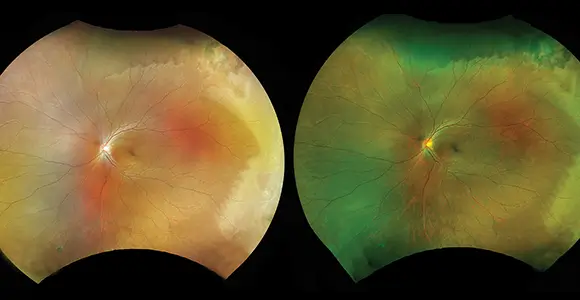 clical paper thumbnail image