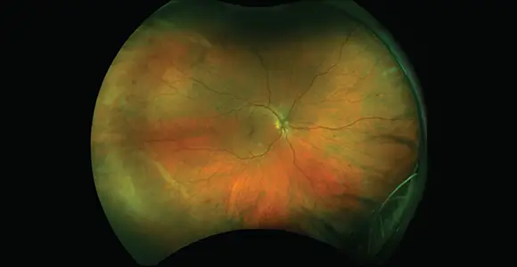 clical paper thumbnail image