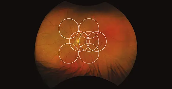 Clinical paper thumbnail image