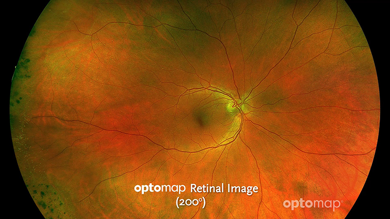 Vimeo video thumbnail