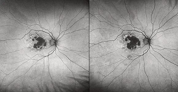 Clinical paper thumbnail image