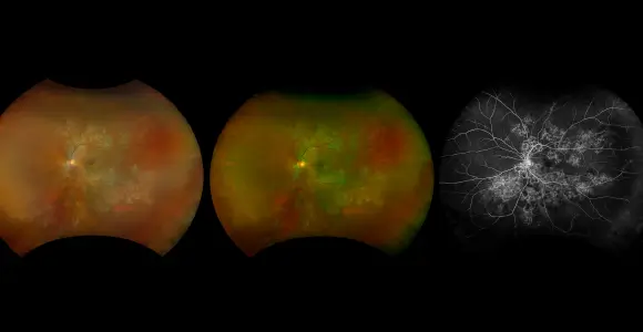 Clinical paper thumbnail image