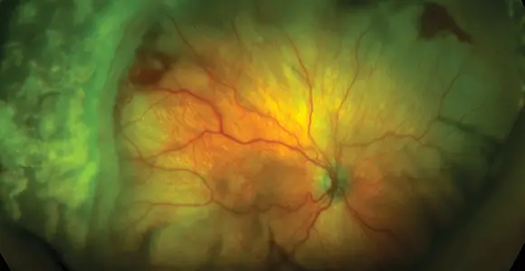 Clinical paper thumbnail image