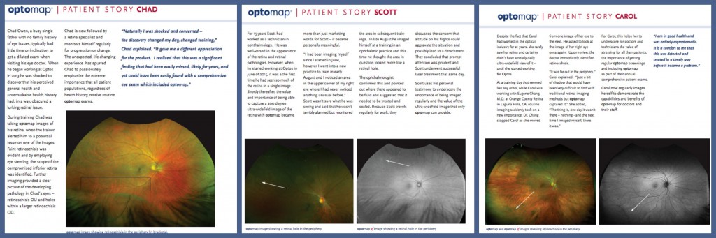 Unexpected Results When “Healthy” People are Examined with UWF Retinal Imaging