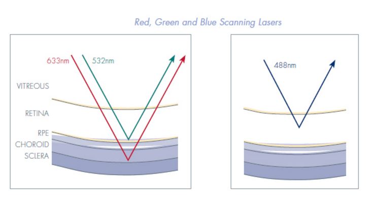 Coherent Laser Light