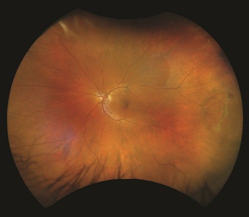 Modality optomap-color-rgb.jpg