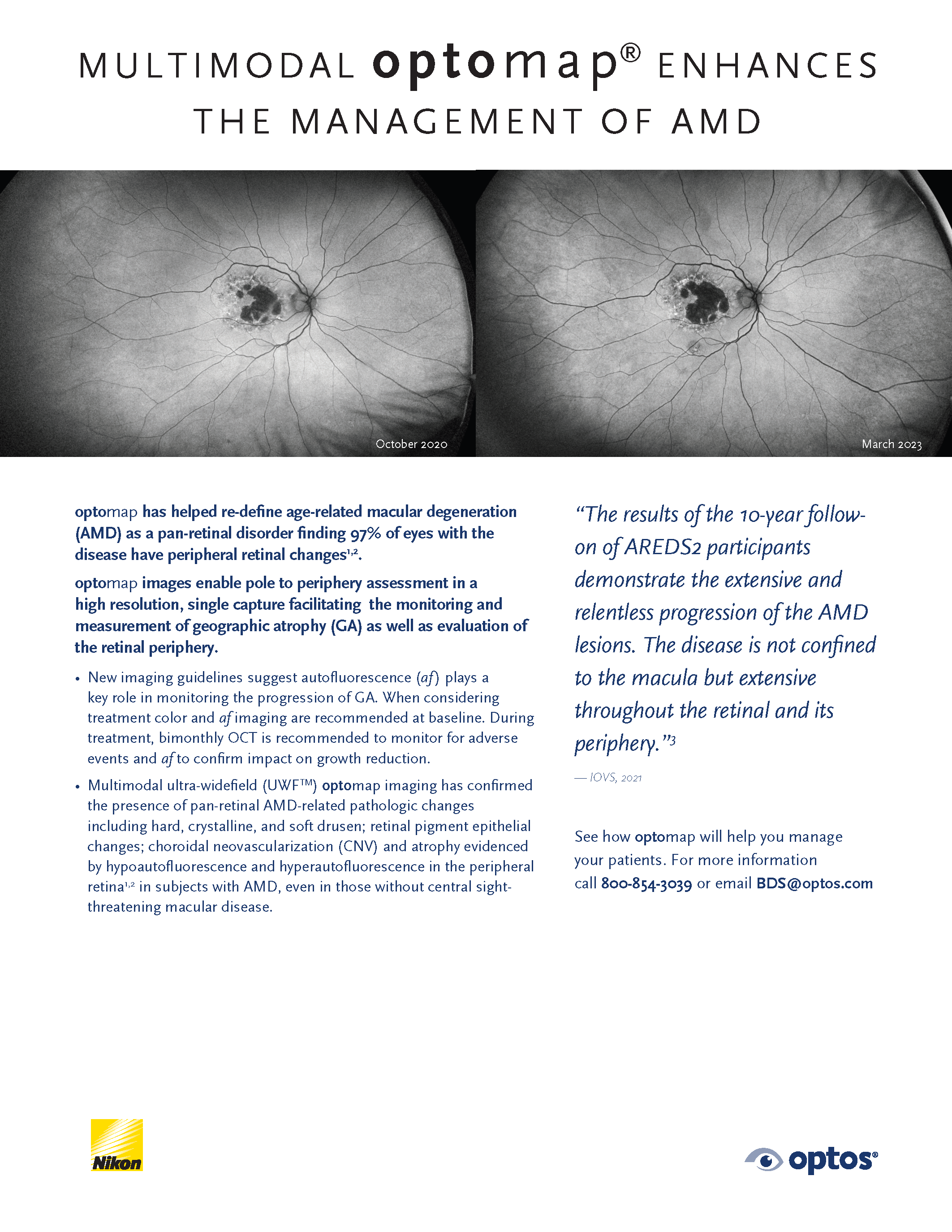 Multimodal optomap enhances management of AMD