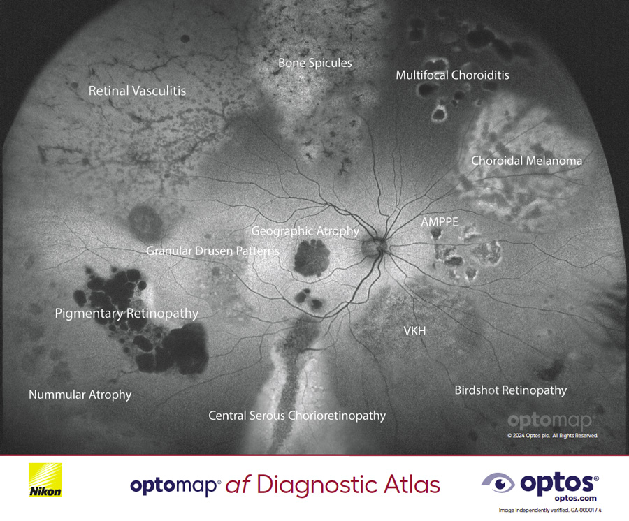 Diagnostic Atlas - optomap af