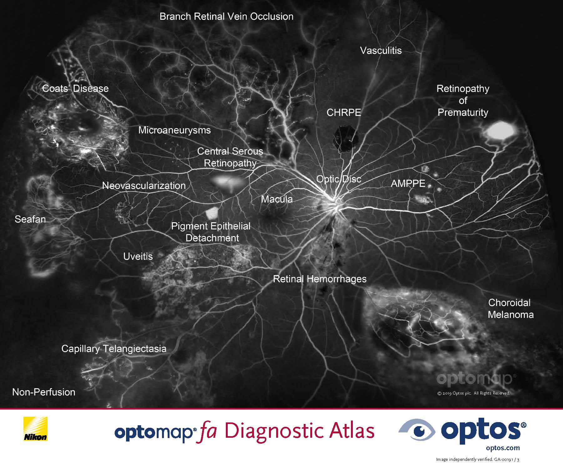 optomap fa Diagnostic Atlas