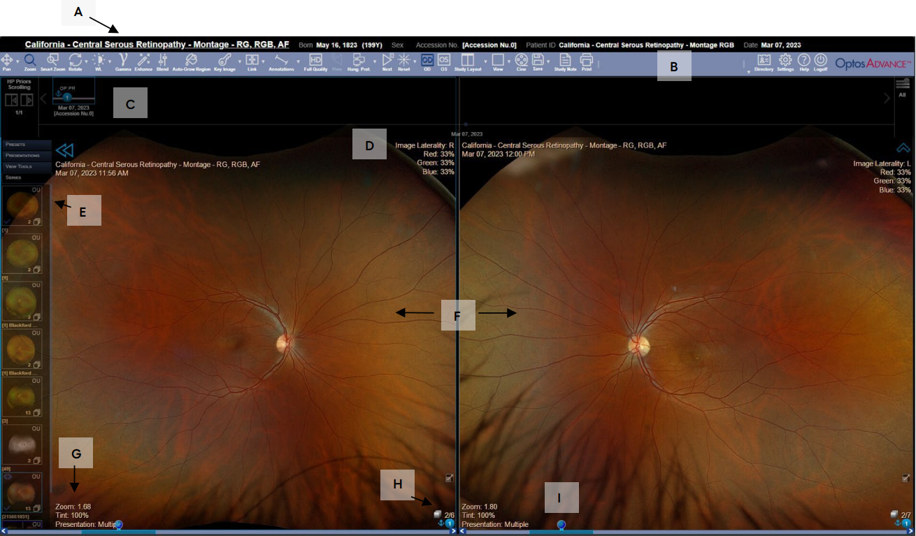OptosAdvance Image Review Instructions